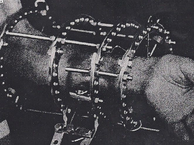 7 – Tratamento da pseudartrose infectada dos ossos do antebraço pelo Método de Ilizarov