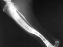 9 – Perdas Ósseas Segmentares