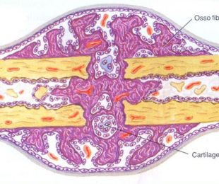 8 – Distúrbios da Consolidação Óssea: Tratamento com Transporte Ósseo