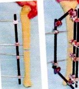 18- ESTRATÉGIAS PARA UMA MELHOR FIXAÇÃO EXTERNA NO TRAUMA